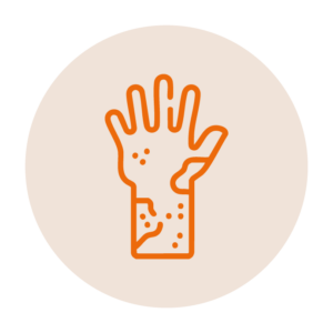 Piel que se<br>descama